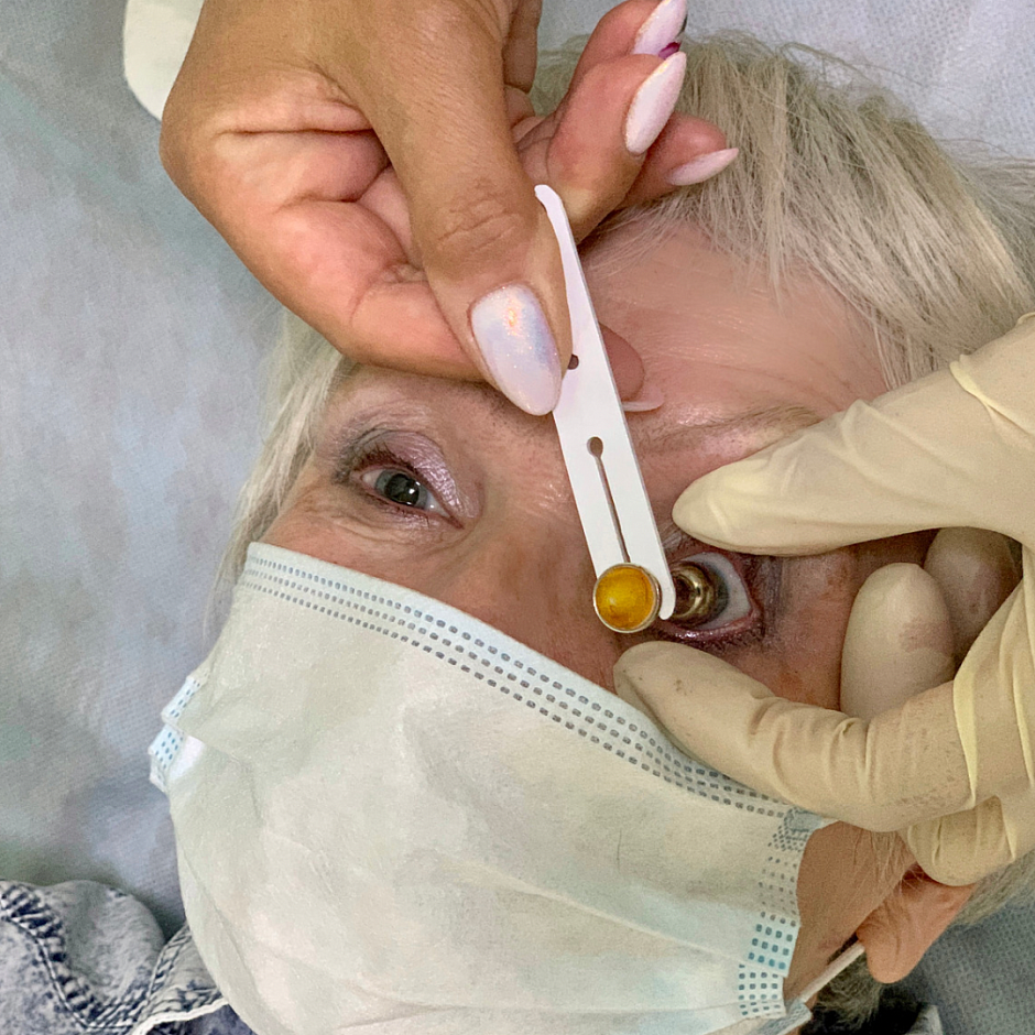 ВНУТРИГЛАЗНОЕ ДАВЛЕНИЕ.